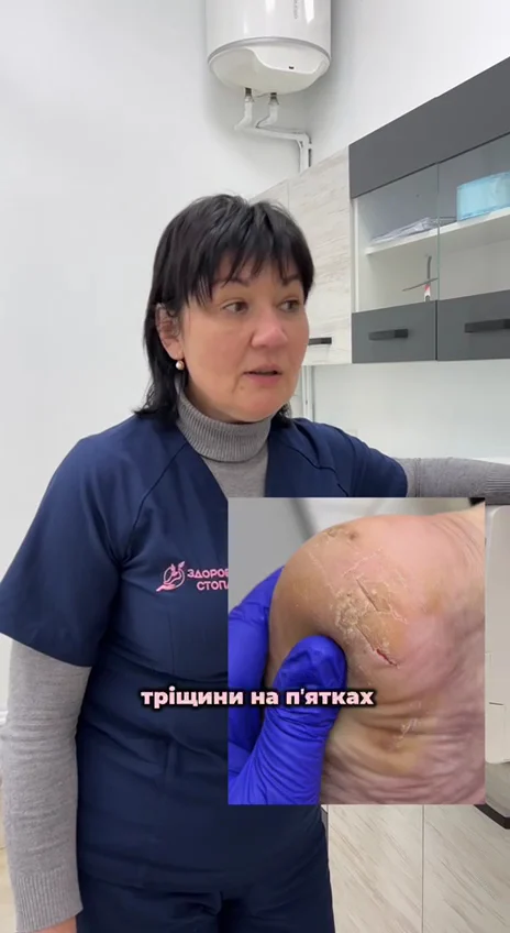 ЗДОРОВА СТОПА-Центр апаратної подологіі Бровари - 2