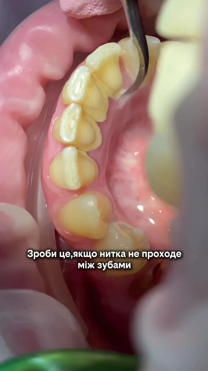 Стоматолог Бориспіль - 2