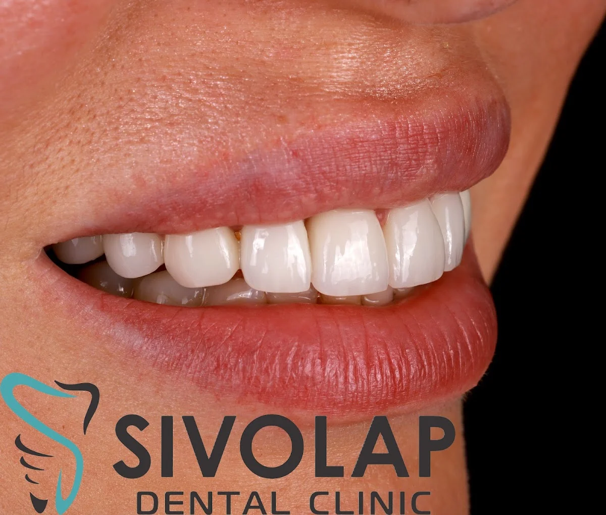Стоматологічна клініка Sivolap Dental Clinic - 3