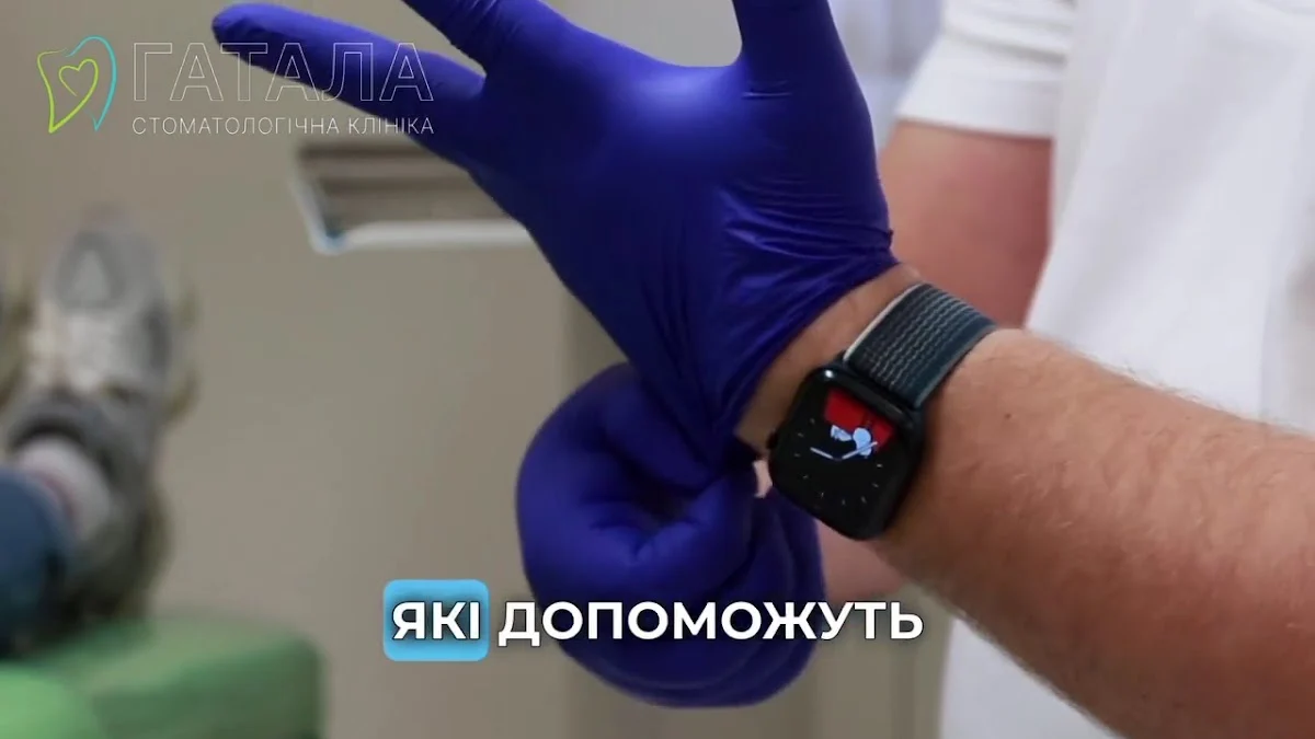 Стоматологія Гатала Львів. Вініри Імпланти Дитяча стоматологія Ортодонт - 4