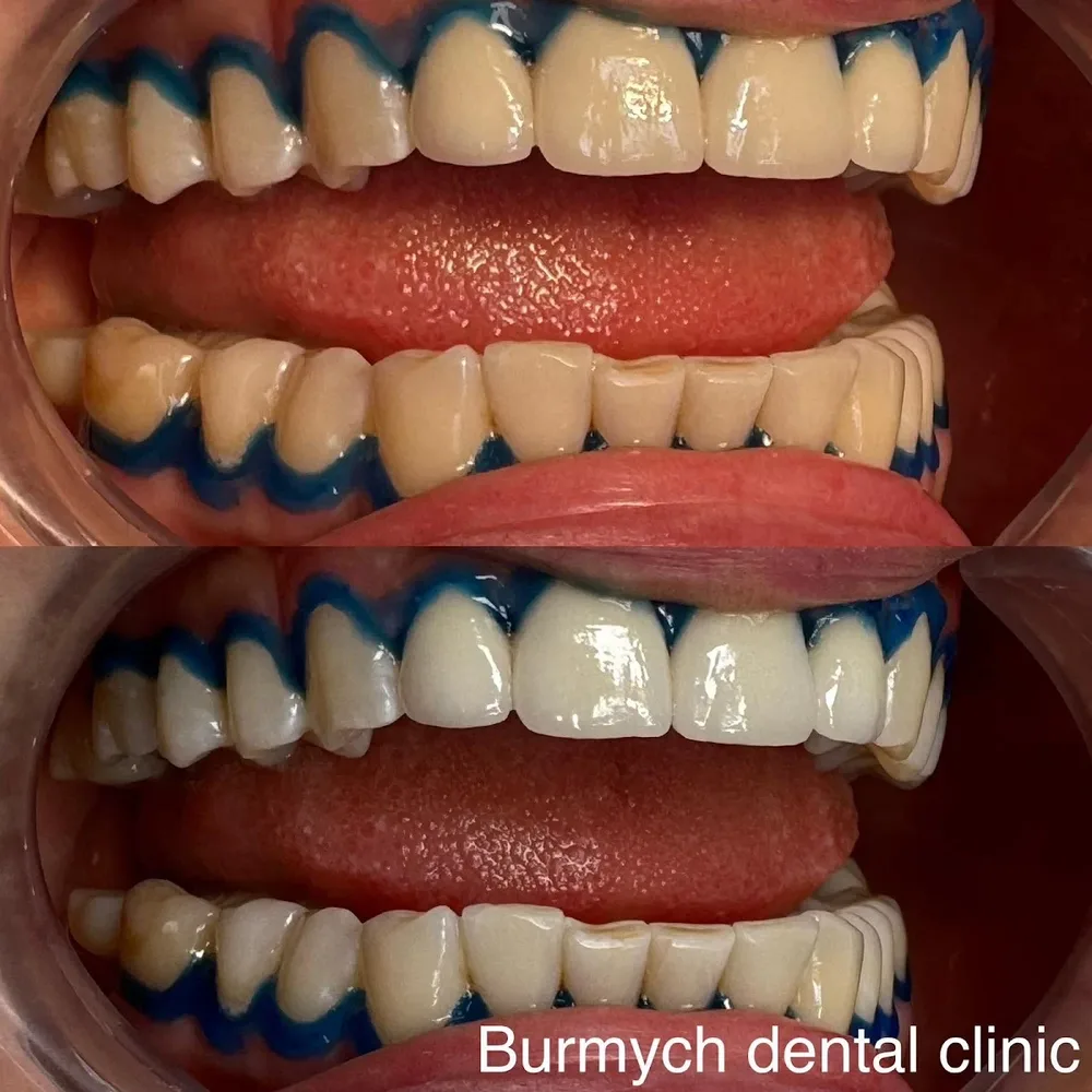 Стоматологія Старий Самбір"Burmych dental clinic"