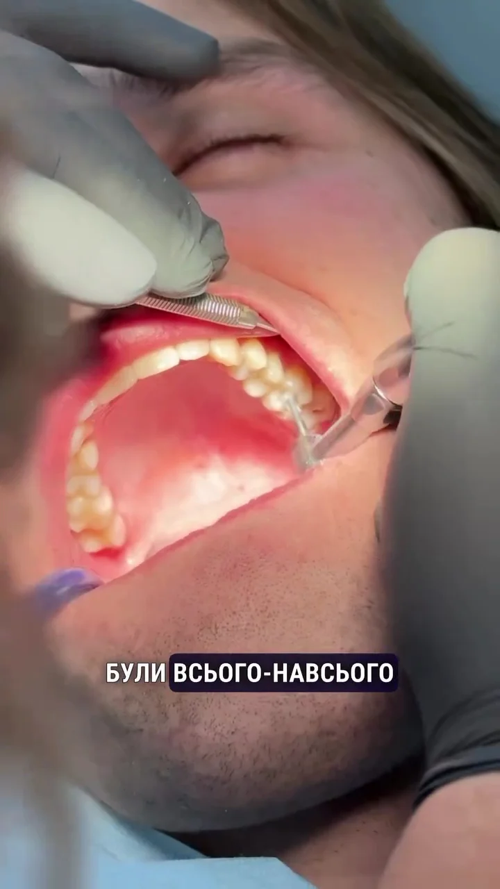 Стоматологія Ірпінь Pro Line dental clinic - 3