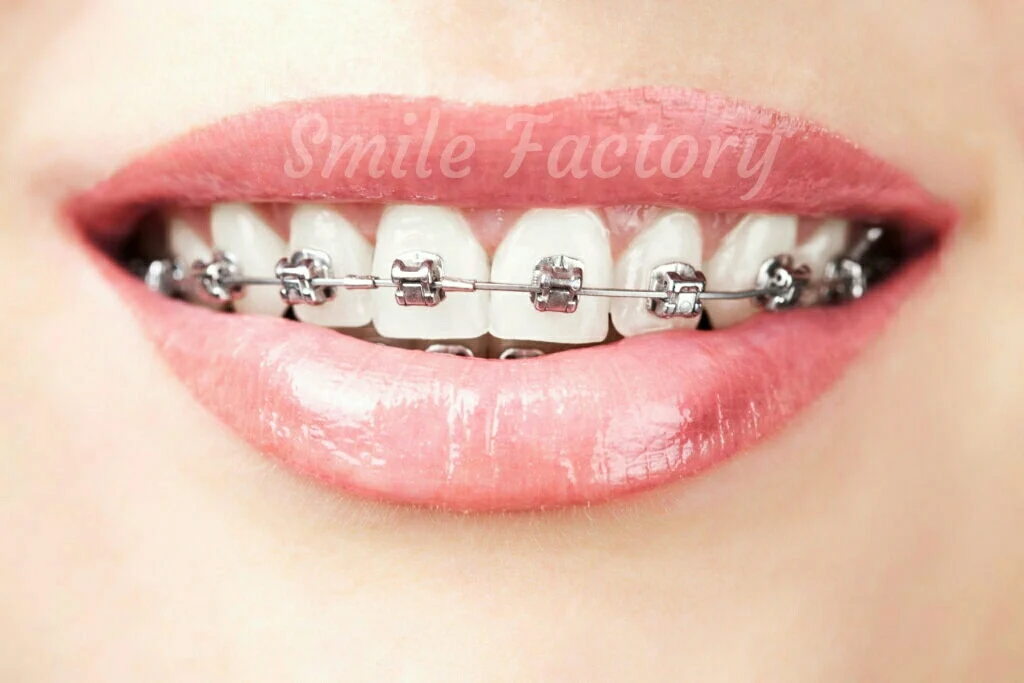 Стоматологія "Smile Factory" - 2