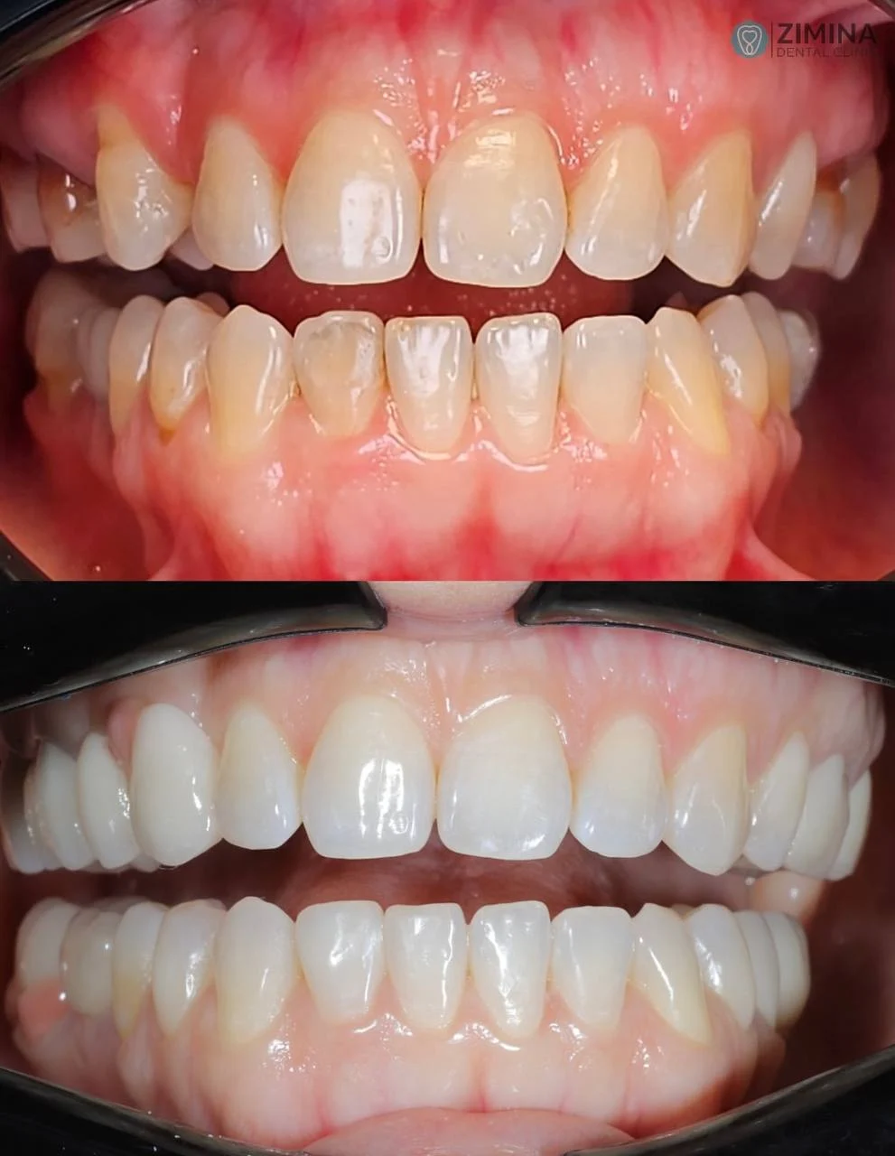Стоматологія Zimina Dental Clinic