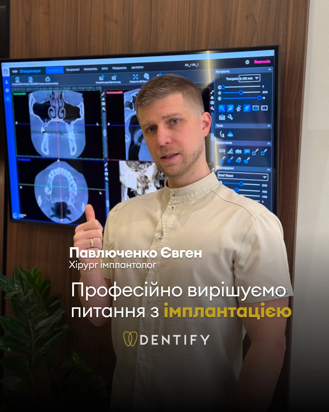 DENTIFY