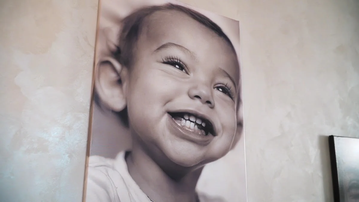 Esthetic smile - 4