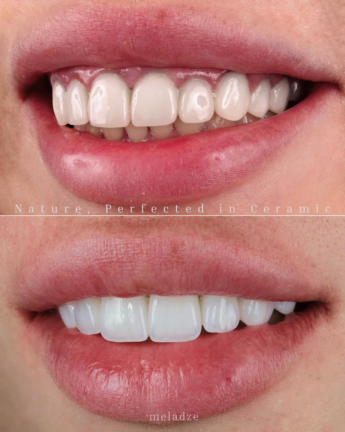 Meladze Dental Clinic