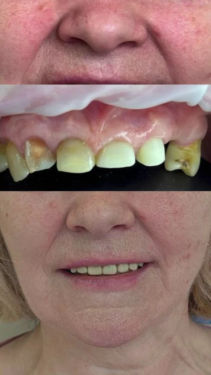 Narin Dental Care - 2