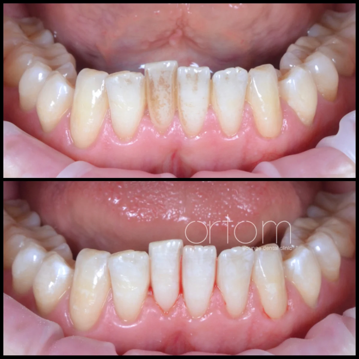 Ortom lounge dental clinic - 4