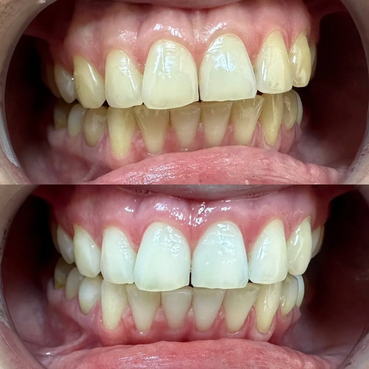 Smilebar