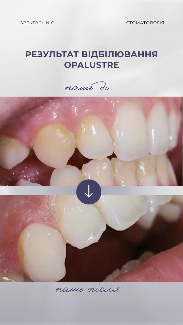 Spektr Dental | Cтоматологія Тернопіль - 2